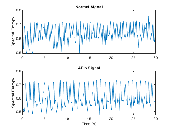 Classify Ecg Signals Using Lstm Networks Artificial Intelligence Matlab And Simulink