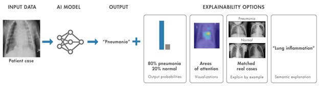 Explainability options that help interpret the AI model's output.