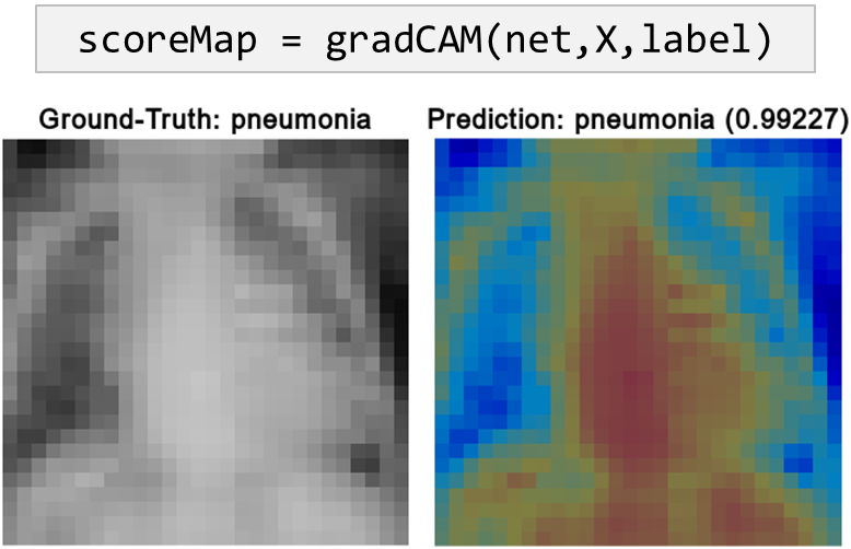 Two images of lungs with pneumonia. The left image is showing the ground truth and the right image is showing the prediction with Grad-CAM.