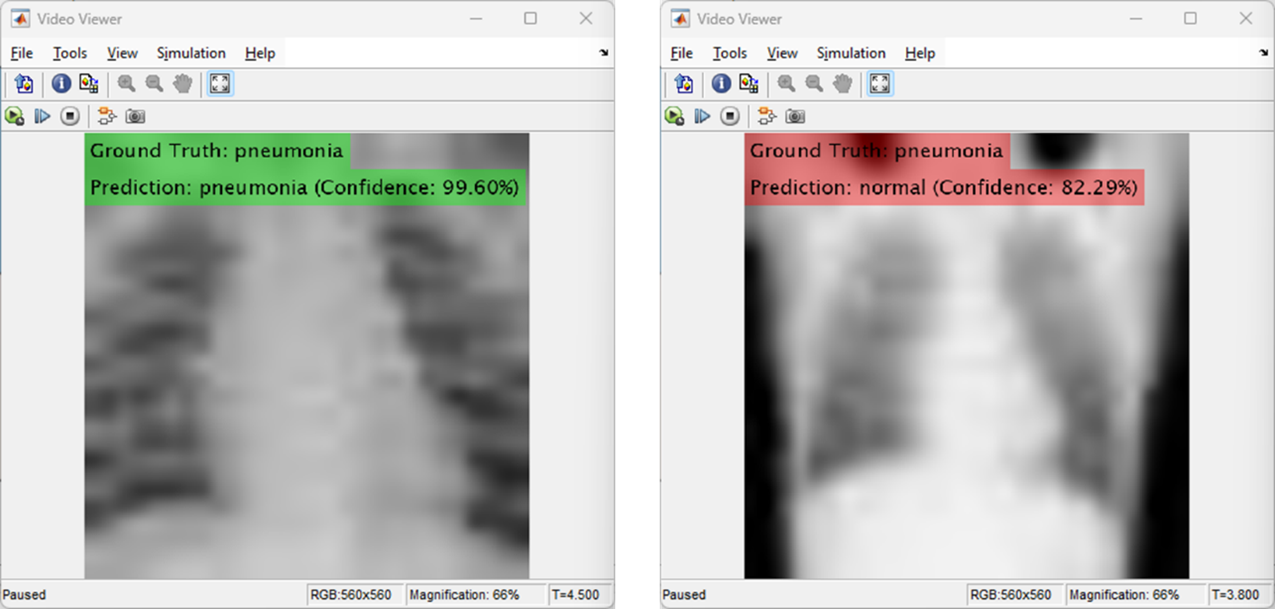 Two lung X-rays with the AI model prediction and the confidence in these predictions.