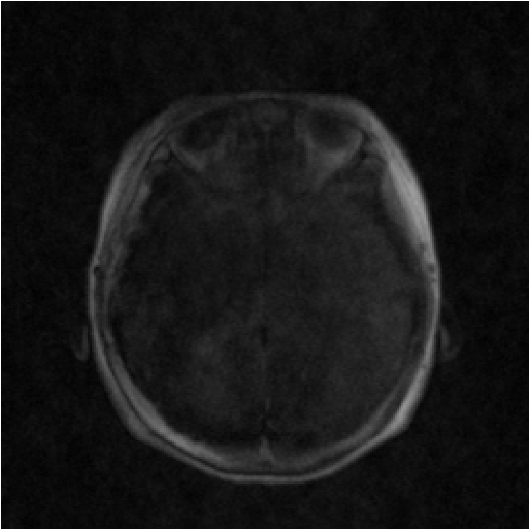 Compressed sensing reconstruction of a representative T1-weighted MRI slice