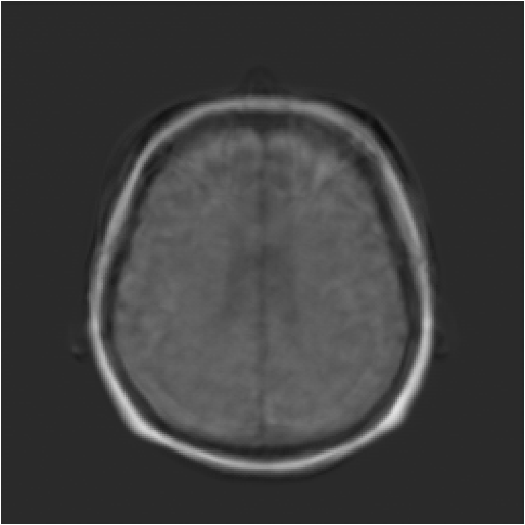 Deep learning reconstruction of a representative T1-weighted MRI slice