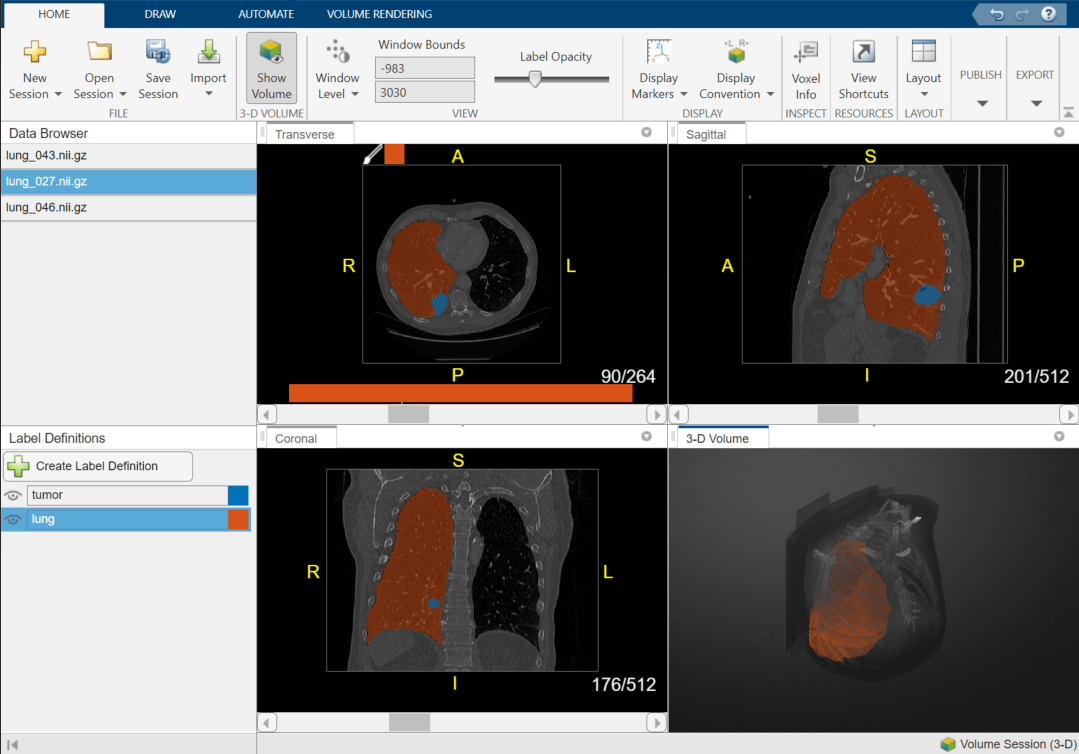 Leveraging Datature Nexus for Tumor and Anomaly Detection in Medical Scans  : Part I